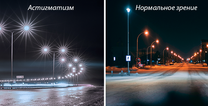 Астигматизм